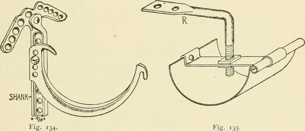 An illustration from Building construction and superintendence, by F.E. Kidder ..., 1896, leaf 160