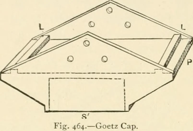 An illustration from Building construction and superintendence, by F.E. Kidder ..., 1896, leaf 435
