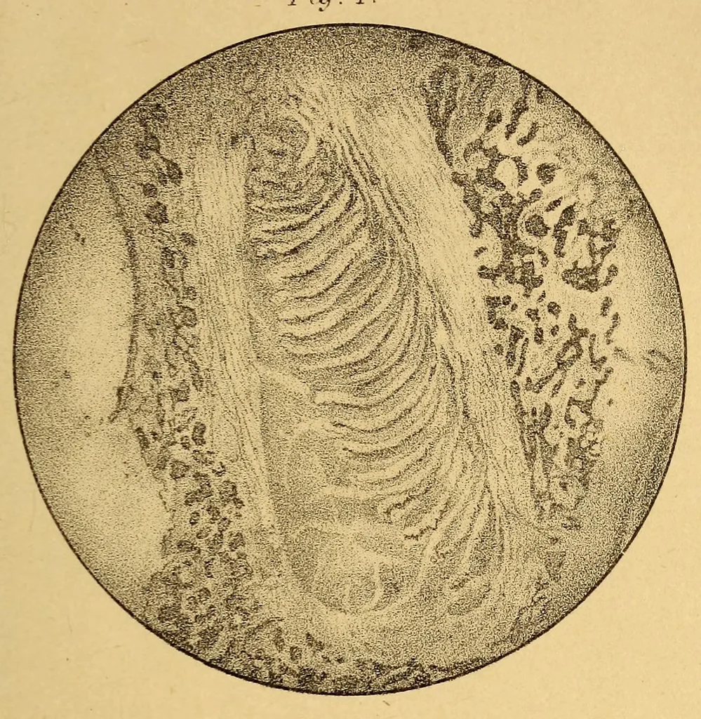 An illustration from Bulletin, 1894, leaf 35
