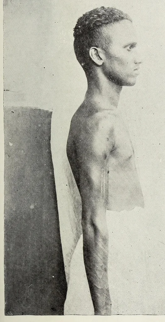 An illustration from Bulletin, 1894, leaf 253