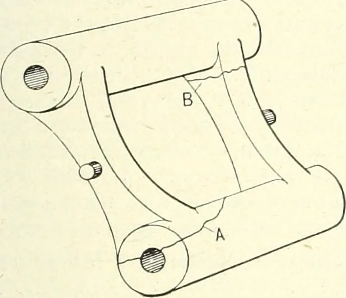 An illustration from Canadian wood products industries, 1914, leaf 312