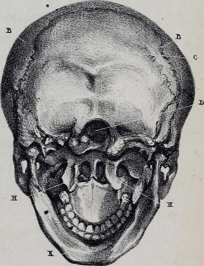 An illustration from Caractères phrénologiques et physiognomoniques des contemporains les plus célèbres, selon les systèmes de Gall, Spurzheim, Lavater, etc., 1837, leaf 50