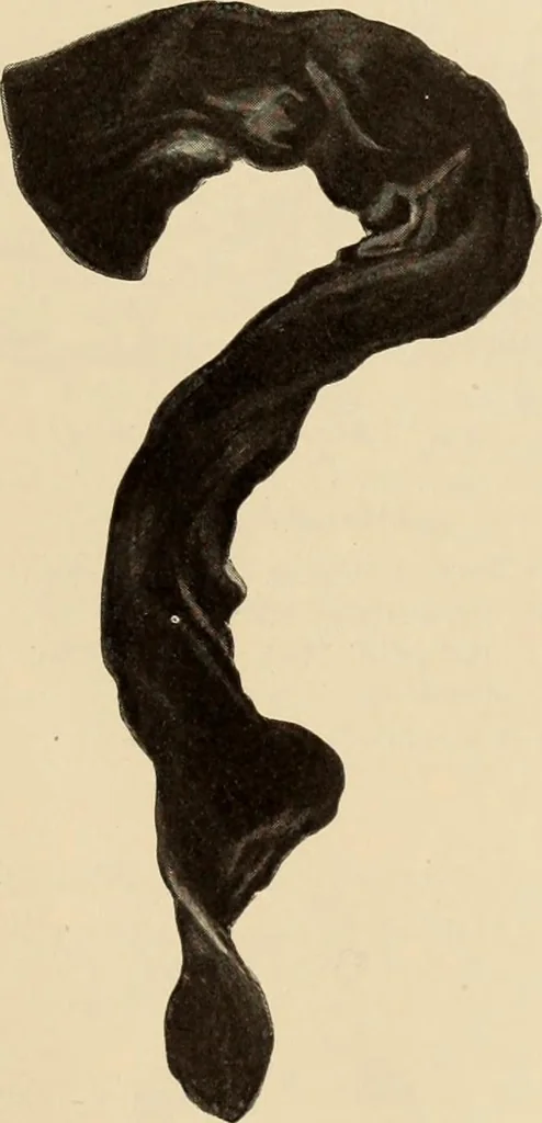 An illustration from Caricature. ed 1911, 1911, leaf 176