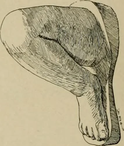 An illustration from Catalogue of plaster reproductions from antique, medieval and modern sculpture : subjects suitable for schools, libraries, and homes., 1911, leaf 181
