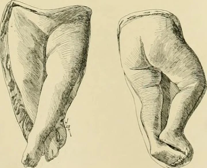 An illustration from Catalogue of plaster cast reproductions from antique, medieval and modern sculpture., 1894, leaf 154