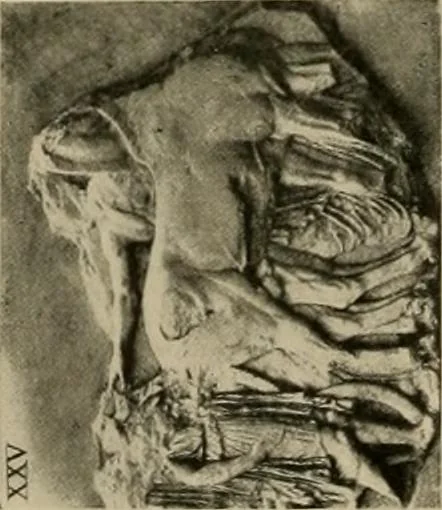 An illustration from Catalogue of plaster reproductions from antique, medieval and modern sculpture : subjects for art schools made and for sale by P.P. Caproni, 1913, leaf 69