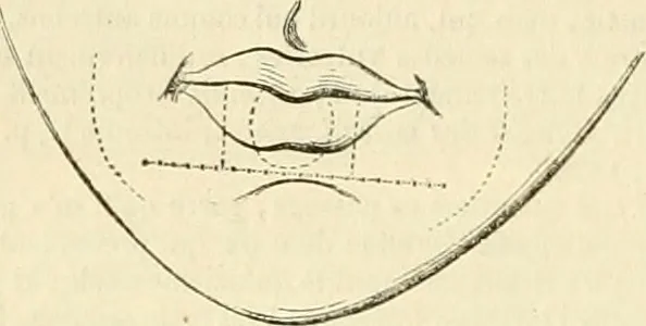 An illustration from Celse, Vitruve, Censorin (oeuvres complètes), Frontin (Des aqueducs de Rome) ; avec la traduction en français [et] publiés sous la direction de M. Nisard, 1866, leaf 305