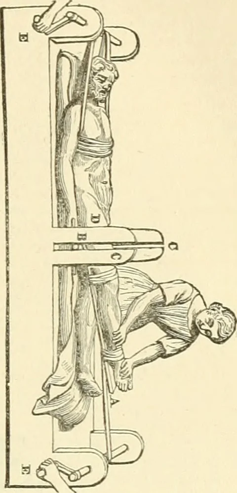 An illustration from Celse, Vitruve, Censorin (oeuvres complètes), Frontin (Des aqueducs de Rome) ; avec la traduction en français [et] publiés sous la direction de M. Nisard, 1866, leaf 308