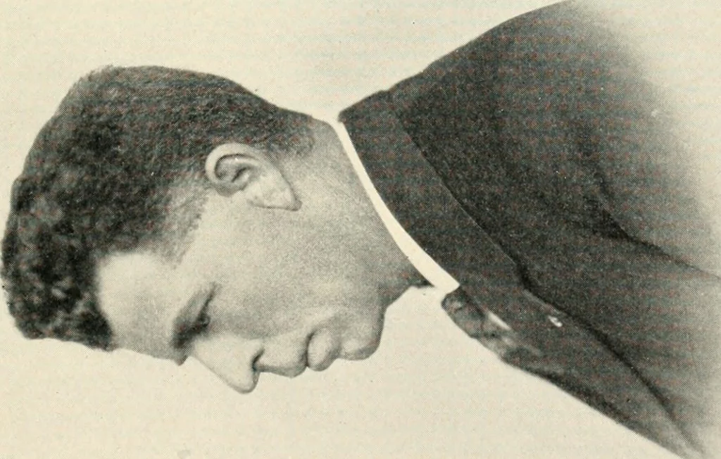 An illustration from Character revelations of mind and body; a statement of methods for the study of the indications of character which are built into the face as a result of mental and bodily reactions, 1922, leaf 216