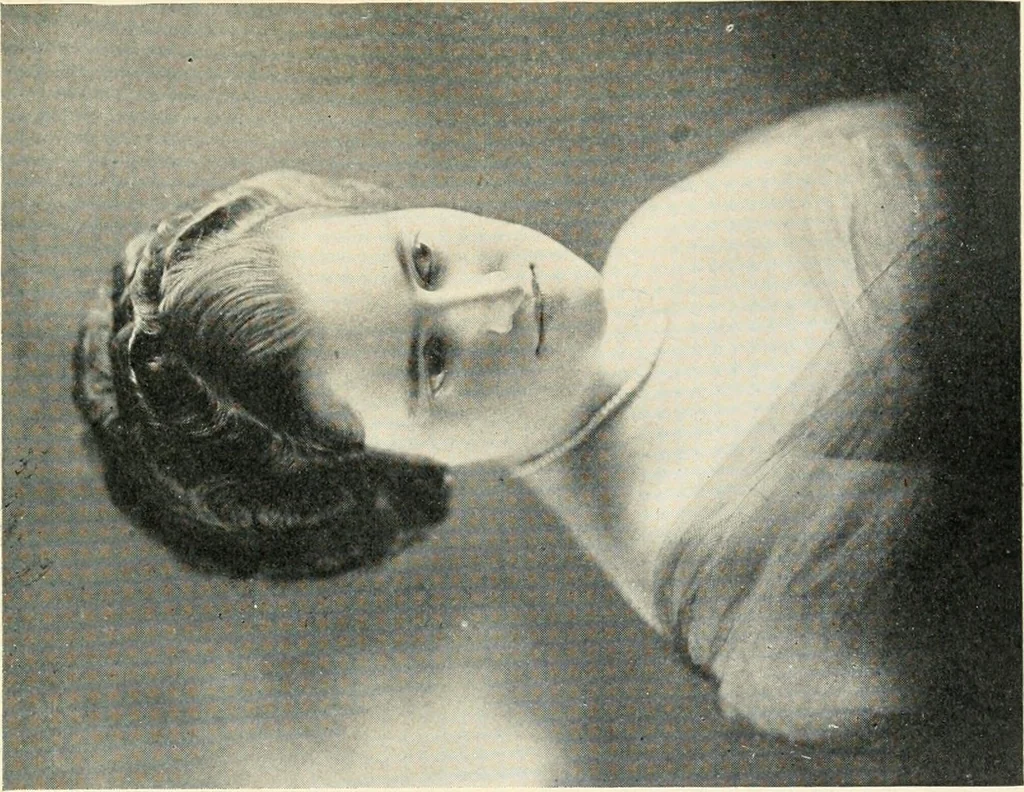An illustration from Character revelations of mind and body; a statement of methods for the study of the indications of character which are built into the face as a result of mental and bodily reactions, 1922, leaf 252