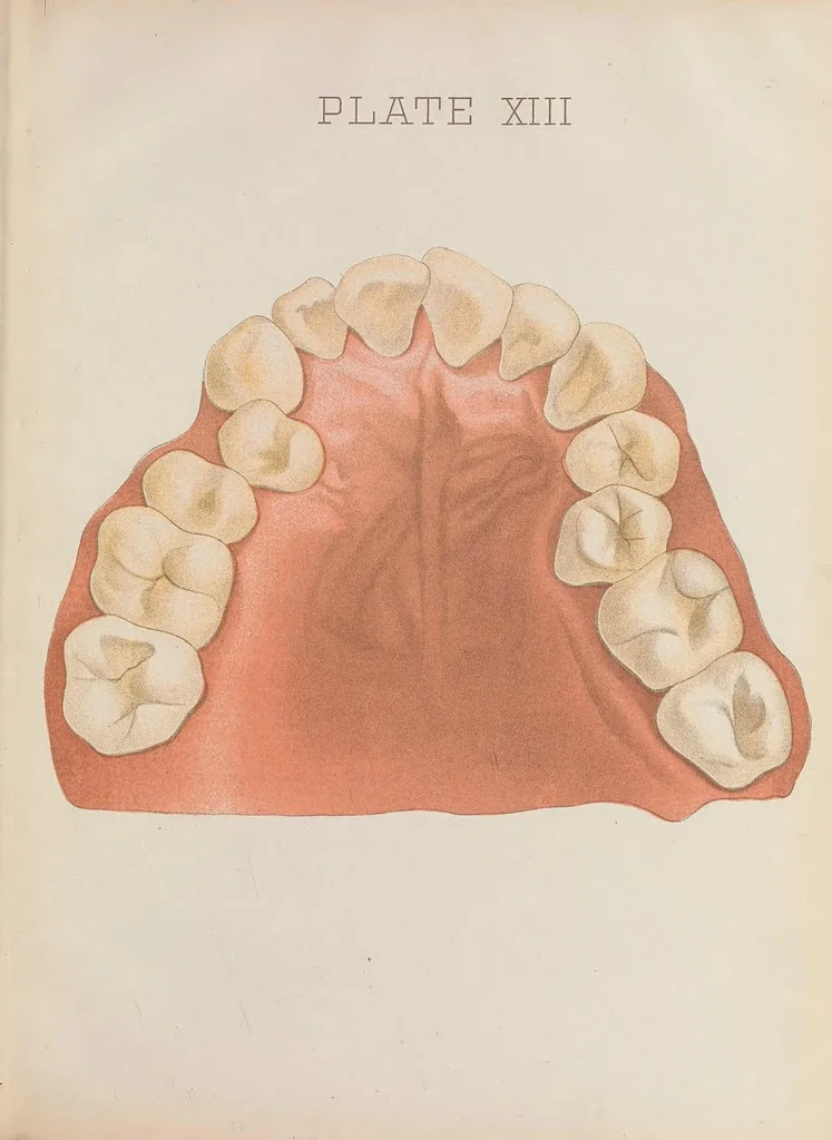 An illustration from Chart of typical forms of constitutional irregularities of the teeth, 1891, leaf 33