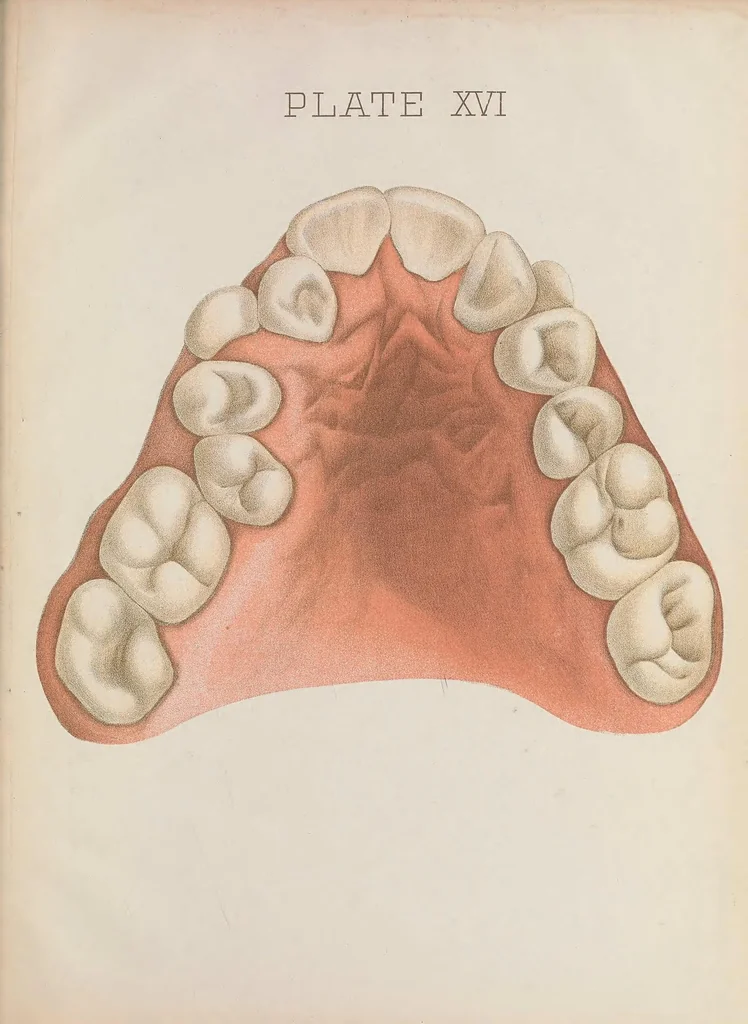 An illustration from Chart of typical forms of constitutional irregularities of the teeth, 1891, leaf 39