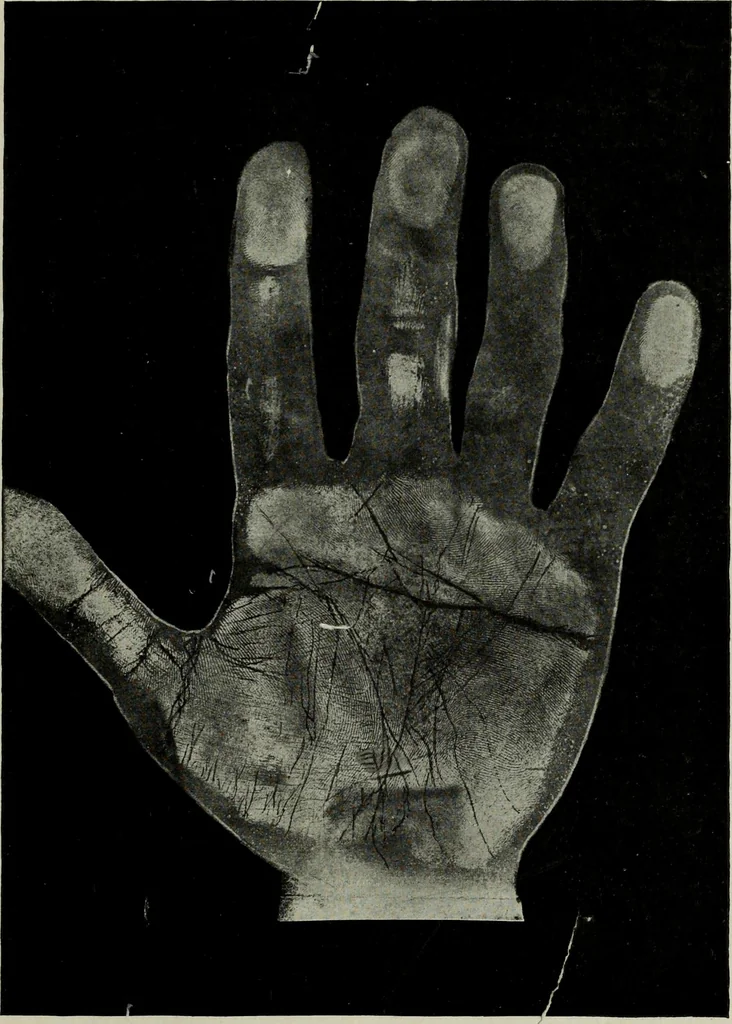 An illustration from Cheiro's language of the hand : complete practical work on the sciences of cheirognomy and cheiromancy, containing the system, rules, and experience of Cheiro [pseud.] fifty-five full-page illustrations, and over two hundred engravings of lines, mounts, and marks, 1900, leaf 230