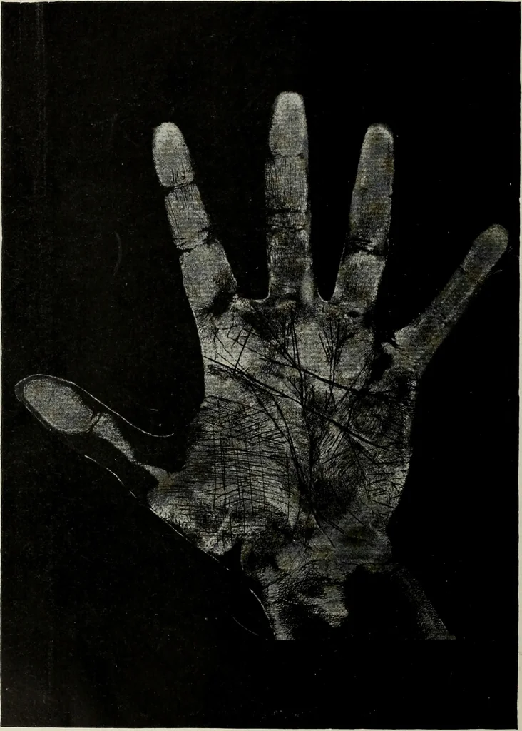 An illustration from Cheiro's language of the hand : complete practical work on the sciences of cheirognomy and cheiromancy, containing the system, rules, and experience of Cheiro [pseud.] fifty-five full-page illustrations, and over two hundred engravings of lines, mounts, and marks, 1900, leaf 235