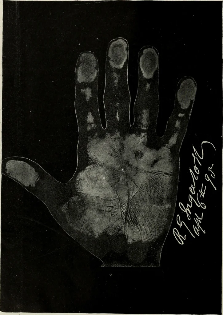 An illustration from Cheiro's language of the hand : complete practical work on the sciences of cheirognomy and cheiromancy, containing the system, rules, and experience of Cheiro [pseud.] fifty-five full-page illustrations, and over two hundred engravings of lines, mounts, and marks, 1900, leaf 237