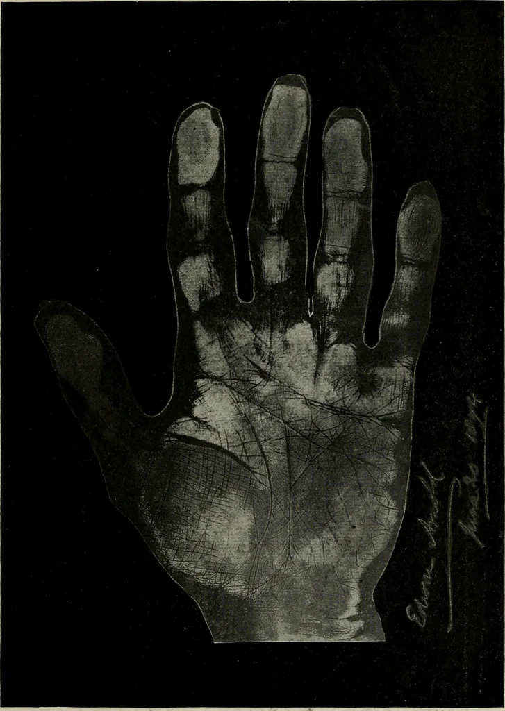 An illustration from Cheiro's language of the hand : complete practical work on the sciences of cheirognomy and cheiromancy, containing the system, rules, and experience of Cheiro [pseud.] fifty-five full-page illustrations, and over two hundred engravings of lines, mounts, and marks, 1900, leaf 246