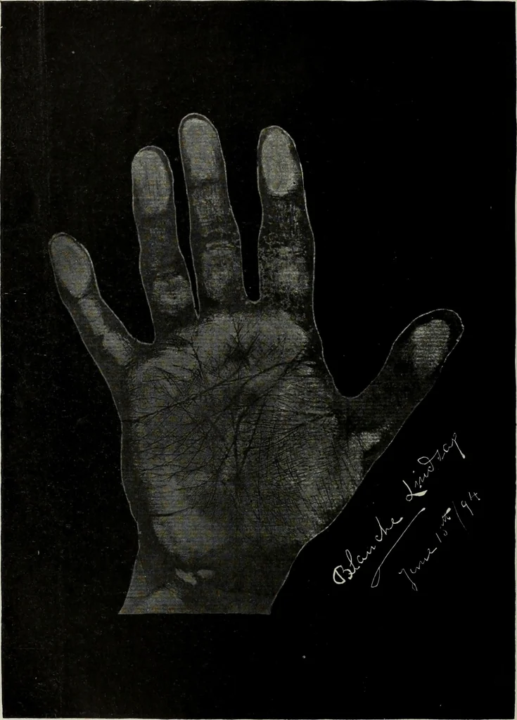 An illustration from Cheiro's language of the hand : complete practical work on the sciences of cheirognomy and cheiromancy, containing the system, rules, and experience of Cheiro [pseud.] fifty-five full-page illustrations, and over two hundred engravings of lines, mounts, and marks, 1900, leaf 251