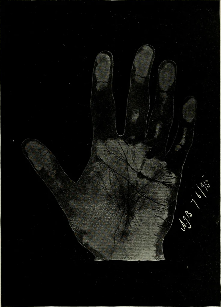 An illustration from Cheiro's language of the hand : complete practical work on the sciences of cheirognomy and cheiromancy, containing the system, rules, and experience of Cheiro [pseud.] fifty-five full-page illustrations, and over two hundred engravings of lines, mounts, and marks, 1900, leaf 254