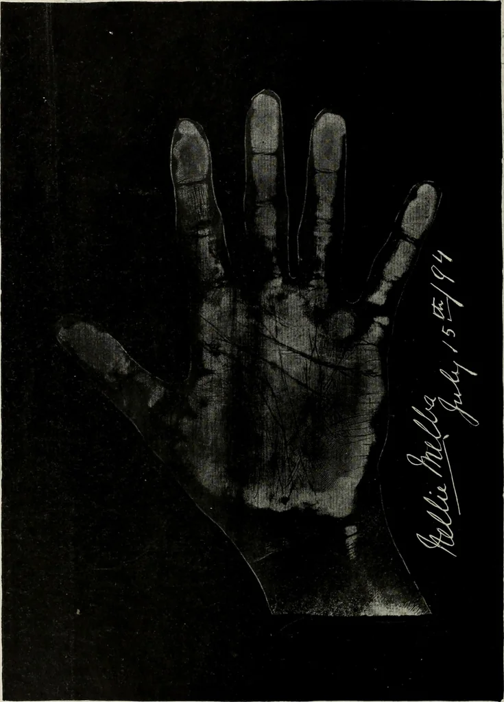 An illustration from Cheiro's language of the hand : complete practical work on the sciences of cheirognomy and cheiromancy, containing the system, rules, and experience of Cheiro [pseud.] fifty-five full-page illustrations, and over two hundred engravings of lines, mounts, and marks, 1900, leaf 255