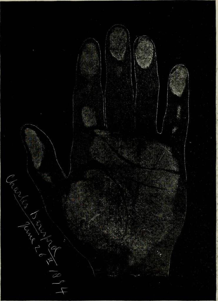 An illustration from Cheiro's language of the hand : complete practical work on the sciences of cheirognomy and cheiromancy, containing the system, rules, and experience of Cheiro [pseud.] fifty-five full-page illustrations, and over two hundred engravings of lines, mounts, and marks, 1900, leaf 256