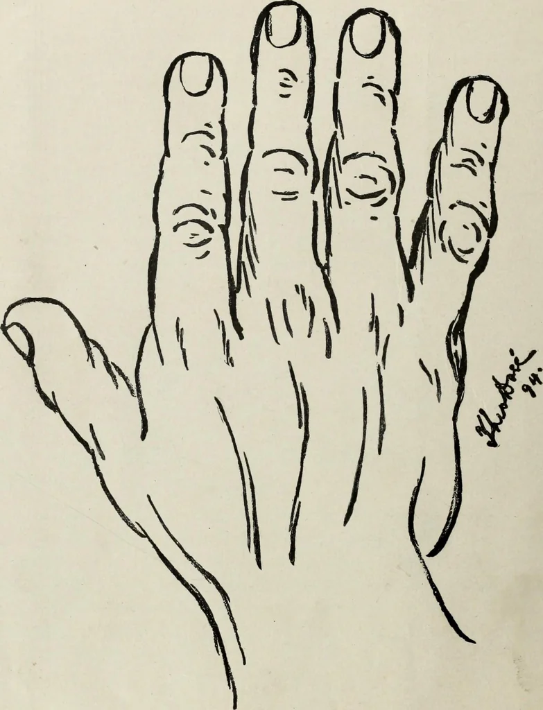 An illustration from Cheiro's language of the hand : complete practical work on the sciences of cheirognomy and cheiromancy, containing the system, rules, and experience of Cheiro [pseud.] fifty-five full-page illustrations, and over two hundred engravings of lines, mounts, and marks, 1900, leaf 49