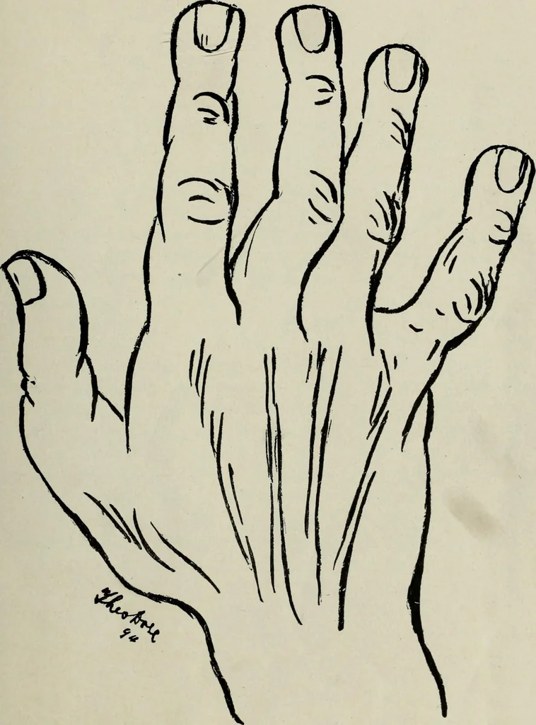 An illustration from Cheiro's language of the hand : complete practical work on the sciences of cheirognomy and cheiromancy, containing the system, rules, and experience of Cheiro [pseud.] fifty-five full-page illustrations, and over two hundred engravings of lines, mounts, and marks, 1900, leaf 58