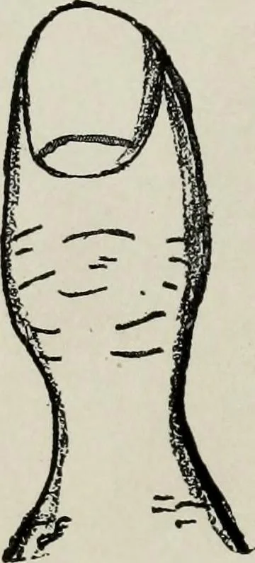 An illustration from Cheiro's language of the hand : complete practical work on the sciences of cheirognomy and cheiromancy, containing the system, rules, and experience of Cheiro [pseud.] fifty-five full-page illustrations, and over two hundred engravings of lines, mounts, and marks, 1900, leaf 79