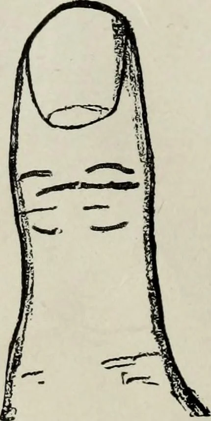 An illustration from Cheiro's language of the hand : complete practical work on the sciences of cheirognomy and cheiromancy, containing the system, rules, and experience of Cheiro [pseud.] fifty-five full-page illustrations, and over two hundred engravings of lines, mounts, and marks, 1900, leaf 79