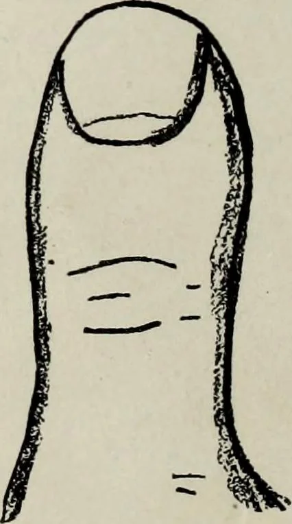 An illustration from Cheiro's language of the hand : complete practical work on the sciences of cheirognomy and cheiromancy, containing the system, rules, and experience of Cheiro [pseud.] fifty-five full-page illustrations, and over two hundred engravings of lines, mounts, and marks, 1900, leaf 79
