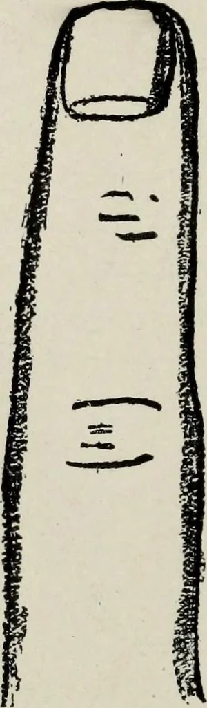 An illustration from Cheiro's language of the hand : complete practical work on the sciences of cheirognomy and cheiromancy, containing the system, rules, and experience of Cheiro [pseud.] fifty-five full-page illustrations, and over two hundred engravings of lines, mounts, and marks, 1900, leaf 87