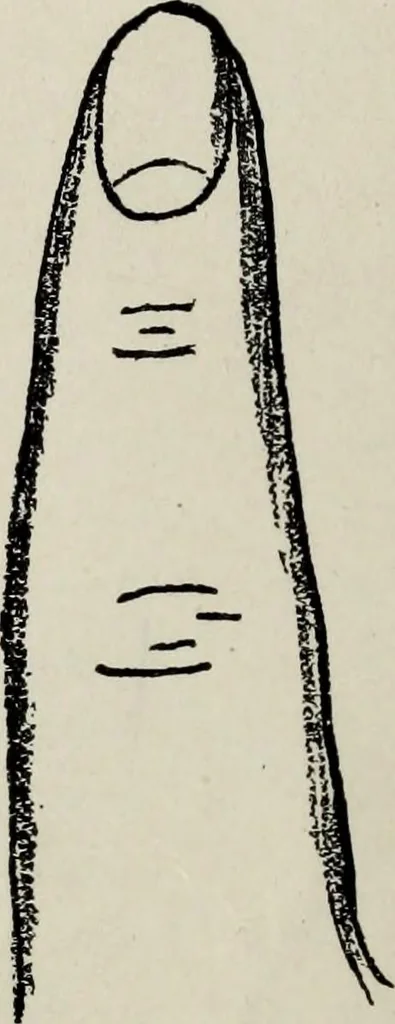 An illustration from Cheiro's language of the hand : complete practical work on the sciences of cheirognomy and cheiromancy, containing the system, rules, and experience of Cheiro [pseud.] fifty-five full-page illustrations, and over two hundred engravings of lines, mounts, and marks, 1900, leaf 87