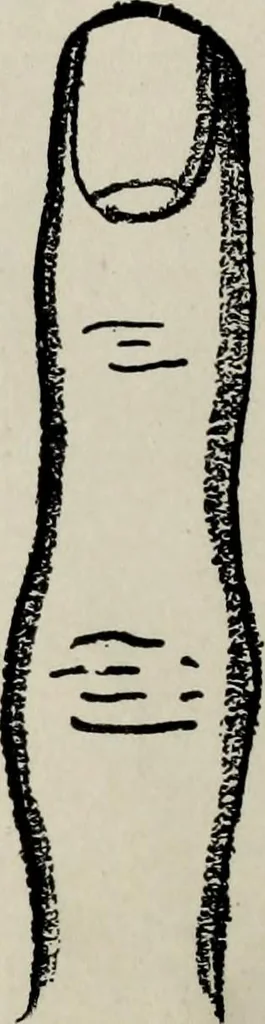 An illustration from Cheiro's language of the hand : complete practical work on the sciences of cheirognomy and cheiromancy, containing the system, rules, and experience of Cheiro [pseud.] fifty-five full-page illustrations, and over two hundred engravings of lines, mounts, and marks, 1900, leaf 87