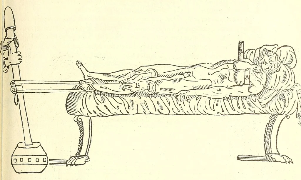 An illustration from Chirurgia, 1544, leaf 213