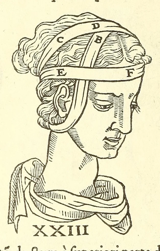 An illustration from Chirurgia, 1544, leaf 468