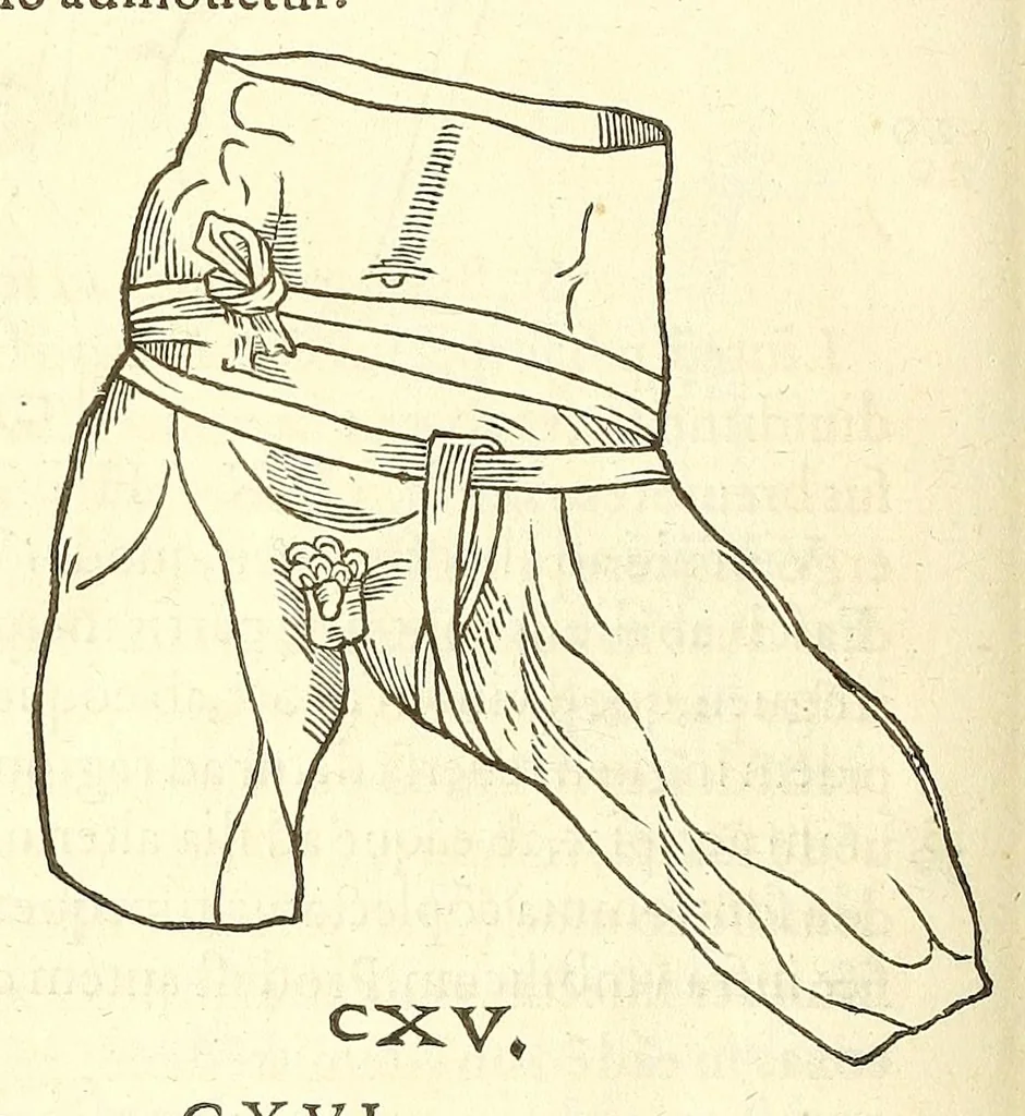 An illustration from Chirurgia, 1544, leaf 498