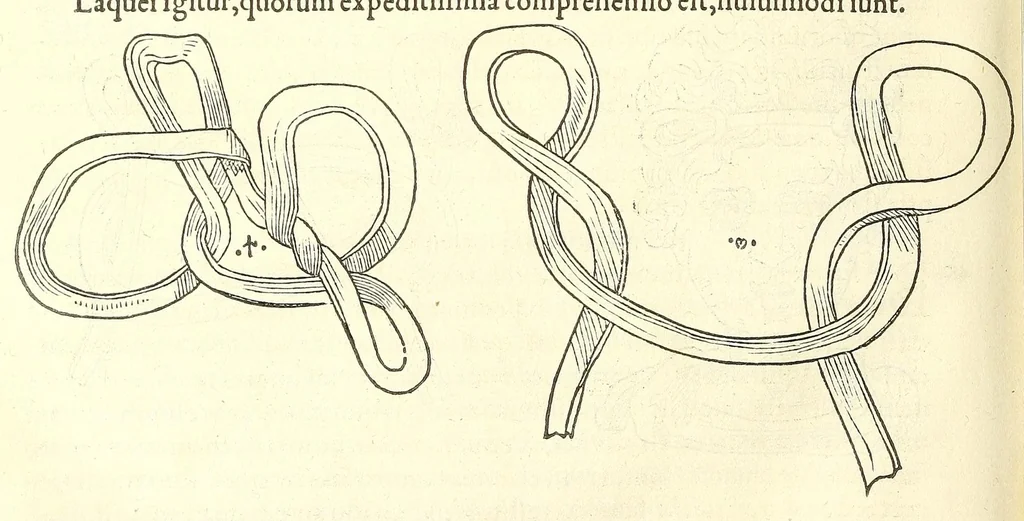 An illustration from Chirurgia, 1544, leaf 516