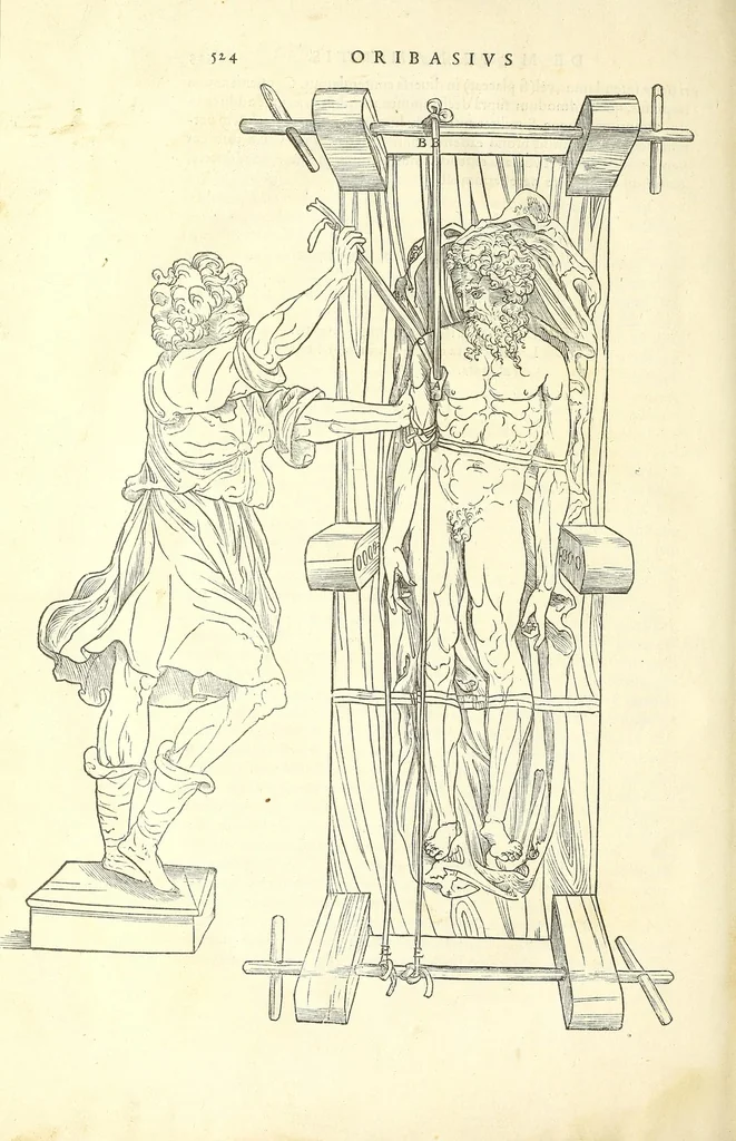 An illustration from Chirurgia, 1544, leaf 564