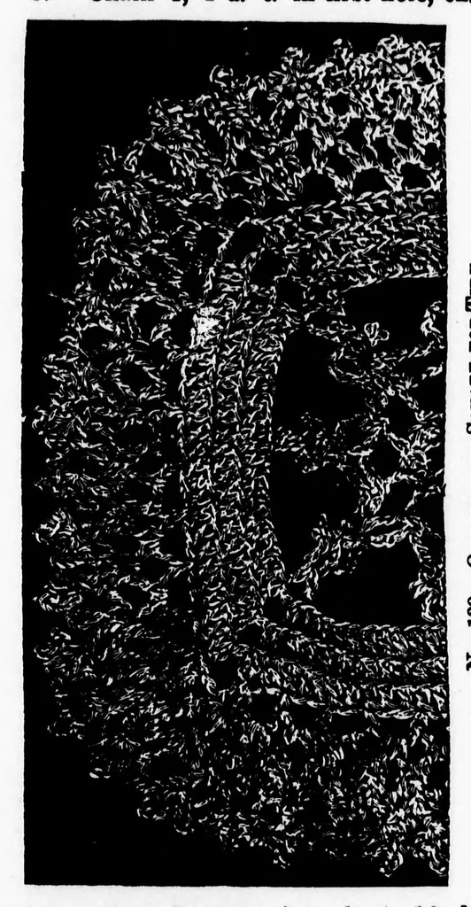 An illustration from Home work [microform] : a choice collection of useful designs for the crochet and knitting needle : also, valuable recipes for the toilet, 1891, leaf 162