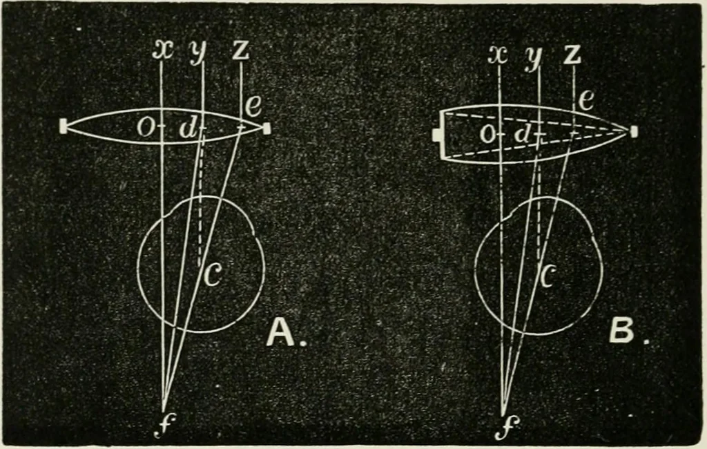 An illustration from The clinical use of prisms; and the decentering of lenses, 1893, leaf 123
