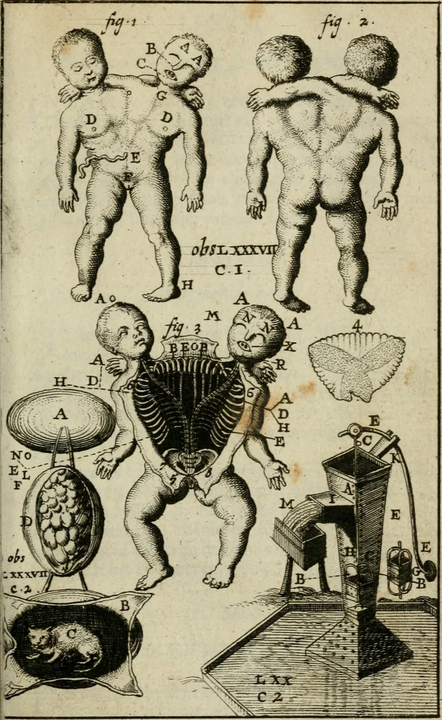 An illustration from Collectanea medico-physica, oft, Hollands jaar-register der genees- en natuur-kundige aanmerkingen van gantsch Europa &c. : beginnende met het jaar MDCLXXX : door eigen ondervinding en gemeen-making van verscheide heeren en liefhebbers, 1680, leaf 184