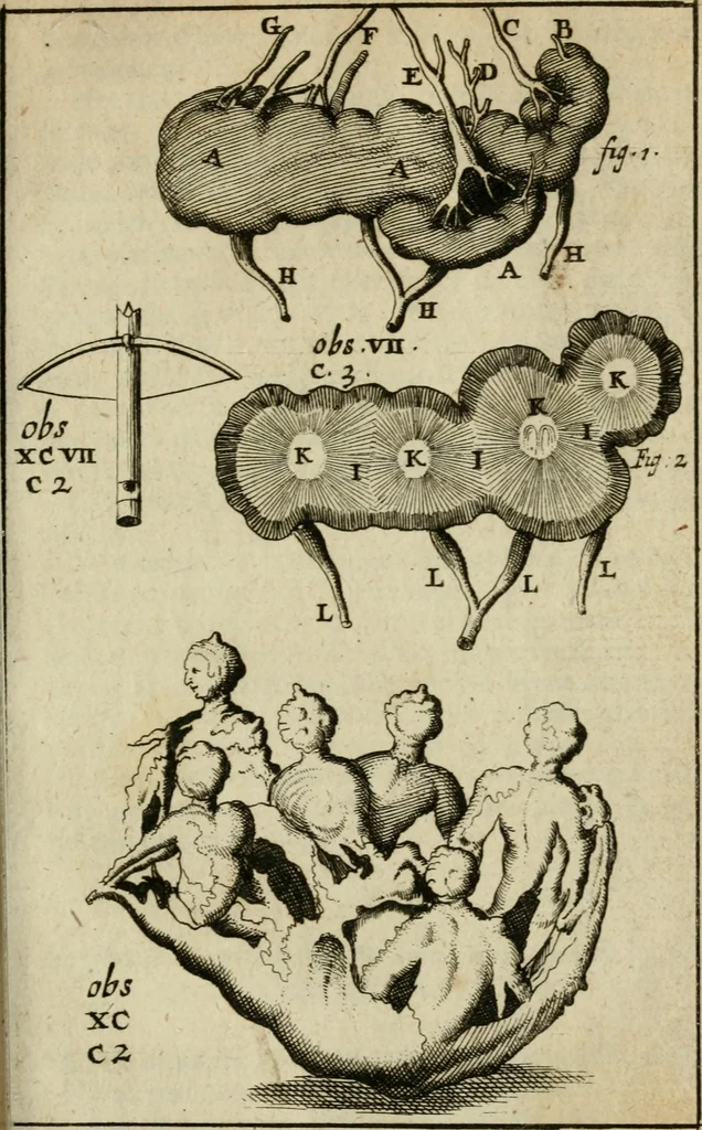 An illustration from Collectanea medico-physica, oft, Hollands jaar-register der genees- en natuur-kundige aanmerkingen van gantsch Europa &c. : beginnende met het jaar MDCLXXX : door eigen ondervinding en gemeen-making van verscheide heeren en liefhebbers, 1680, leaf 208