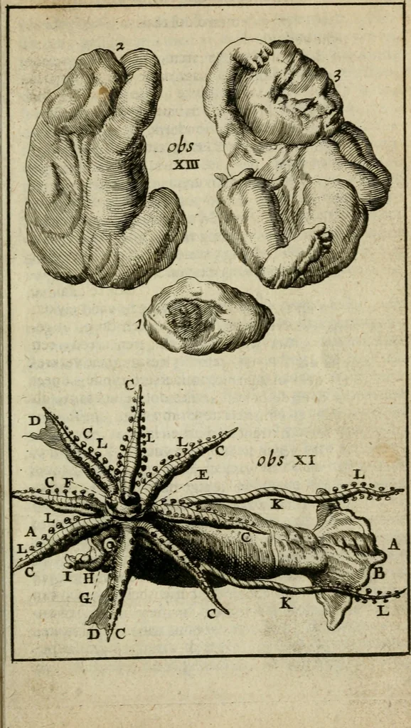 An illustration from Collectanea medico-physica, oft, Hollands jaar-register der genees- en natuur-kundige aanmerkingen van gantsch Europa &c. : beginnende met het jaar MDCLXXX : door eigen ondervinding en gemeen-making van verscheide heeren en liefhebbers, 1680, leaf 28