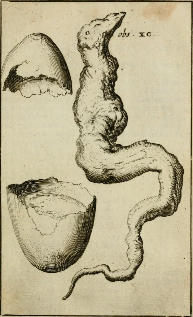 An illustration from Collectanea medico-physica, oft, Hollands jaar-register der genees- en natuur-kundige aanmerkingen van gantsch Europa &c. : beginnende met het jaar MDCLXXX : door eigen ondervinding en gemeen-making van verscheide heeren en liefhebbers, 1680, leaf 314