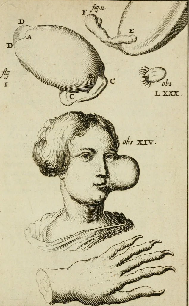 An illustration from Collectanea medico-physica, oft, Hollands jaar-register der genees- en natuur-kundige aanmerkingen van gantsch Europa &c. : beginnende met het jaar MDCLXXX : door eigen ondervinding en gemeen-making van verscheide heeren en liefhebbers, 1680, leaf 378