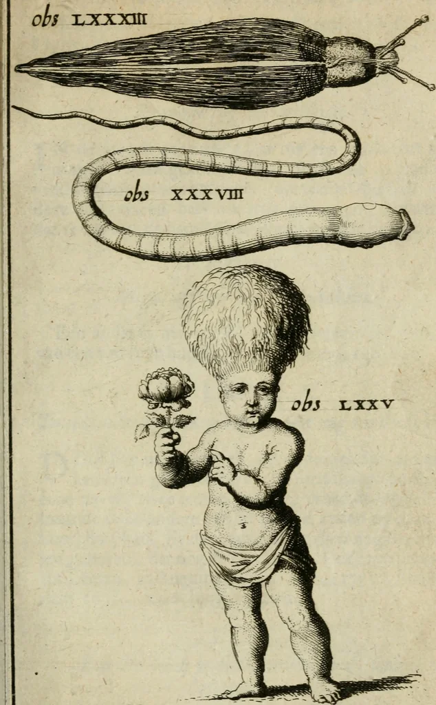 An illustration from Collectanea medico-physica, oft, Hollands jaar-register der genees- en natuur-kundige aanmerkingen van gantsch Europa &c. : beginnende met het jaar MDCLXXX : door eigen ondervinding en gemeen-making van verscheide heeren en liefhebbers, 1680, leaf 86