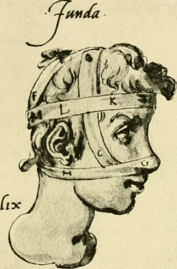 An illustration from Collection de chirurgiens grecs avec dessins attribués au Primatice. Reproduction réduite des 200 dessins du Manuscrit latin 6866 de la Bibliothèque nationale, 1908, leaf 100