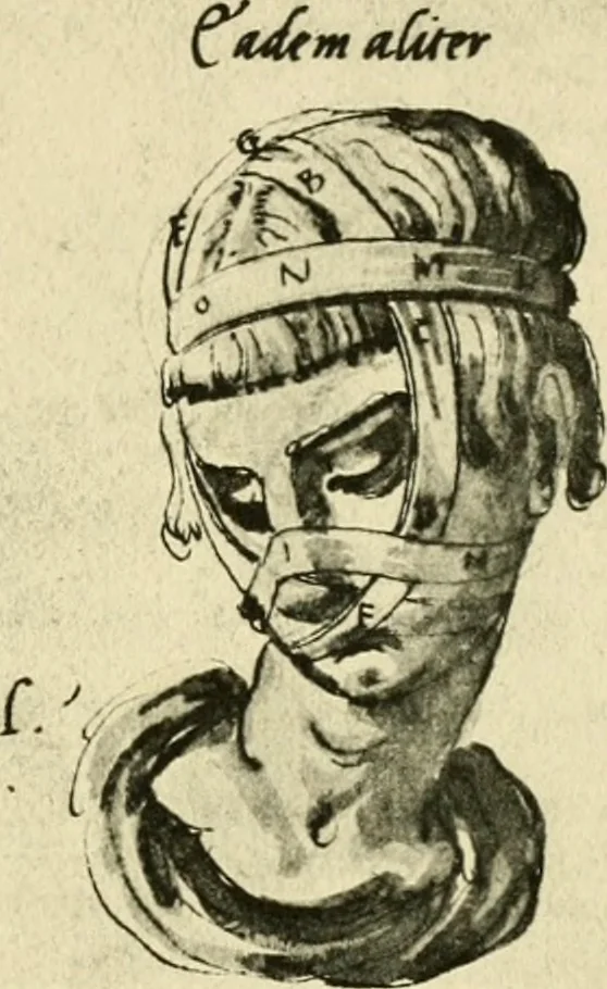 An illustration from Collection de chirurgiens grecs avec dessins attribués au Primatice. Reproduction réduite des 200 dessins du Manuscrit latin 6866 de la Bibliothèque nationale, 1908, leaf 100