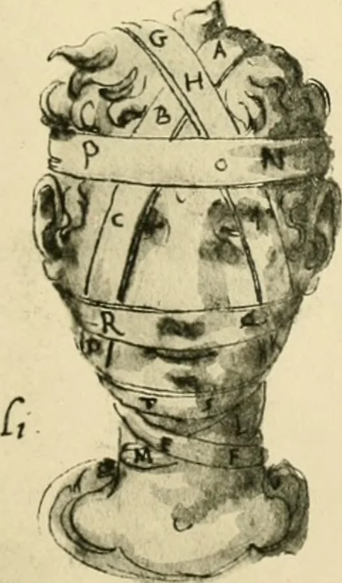 An illustration from Collection de chirurgiens grecs avec dessins attribués au Primatice. Reproduction réduite des 200 dessins du Manuscrit latin 6866 de la Bibliothèque nationale, 1908, leaf 100