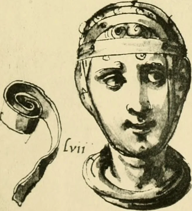 An illustration from Collection de chirurgiens grecs avec dessins attribués au Primatice. Reproduction réduite des 200 dessins du Manuscrit latin 6866 de la Bibliothèque nationale, 1908, leaf 104