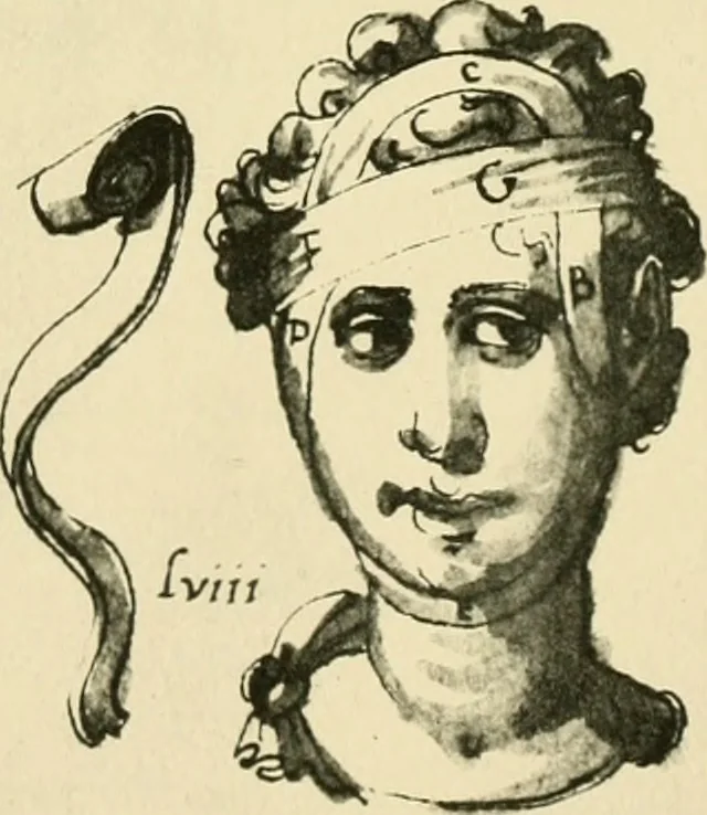 An illustration from Collection de chirurgiens grecs avec dessins attribués au Primatice. Reproduction réduite des 200 dessins du Manuscrit latin 6866 de la Bibliothèque nationale, 1908, leaf 104